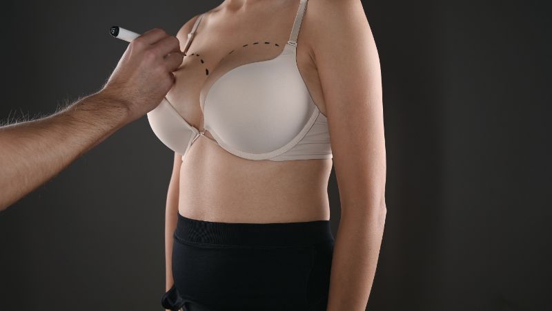Unveil Your Inner Confidence: Breast Augmentation Experts in Miami