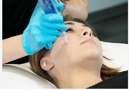 Your Guide to Skin Pen and VI Peel Precision Plus Treatments