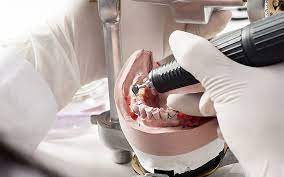 Dental Lab Technologies: Elevating the Standards of Prosthetic Dentistry
